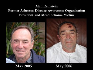 Alan Reinstein